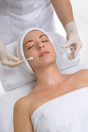 chemical peel